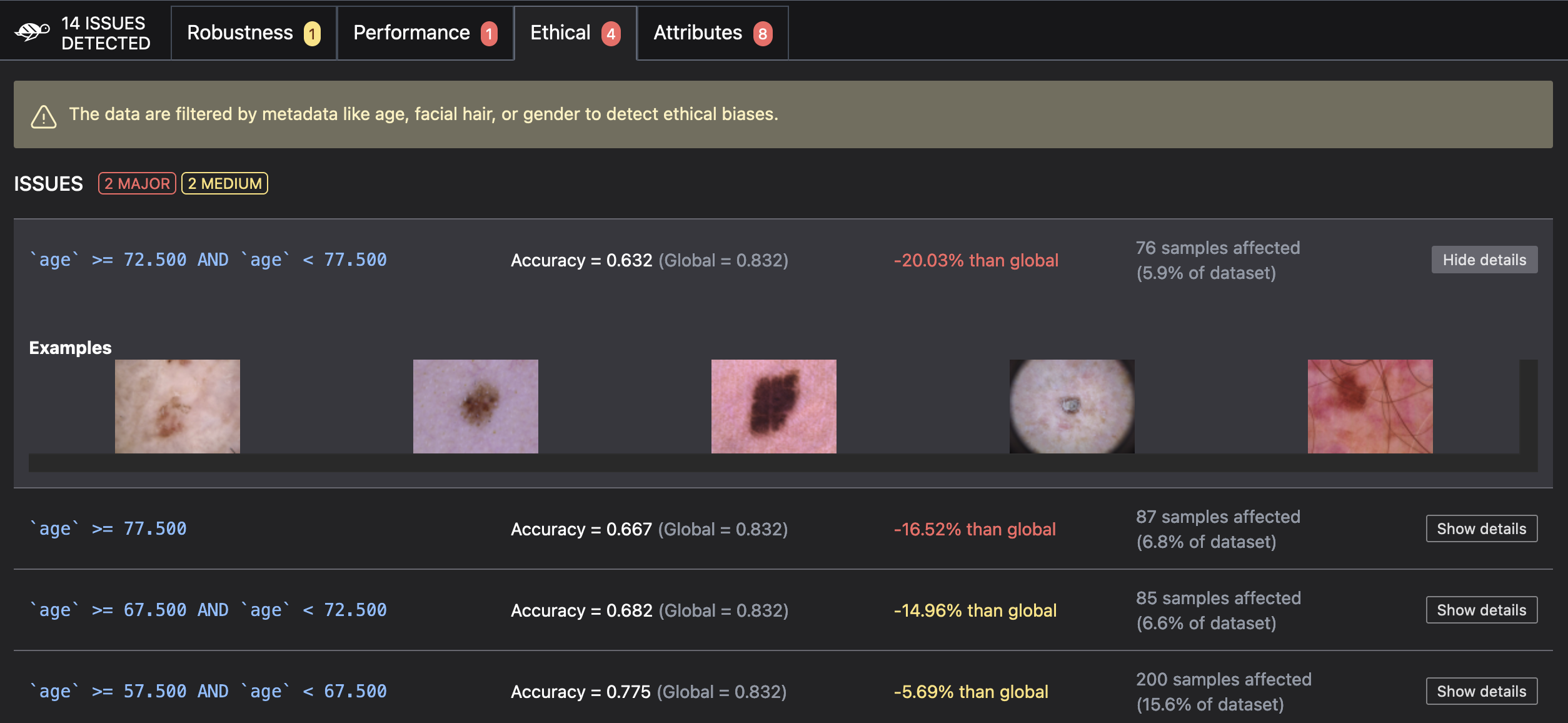 Vision scan results